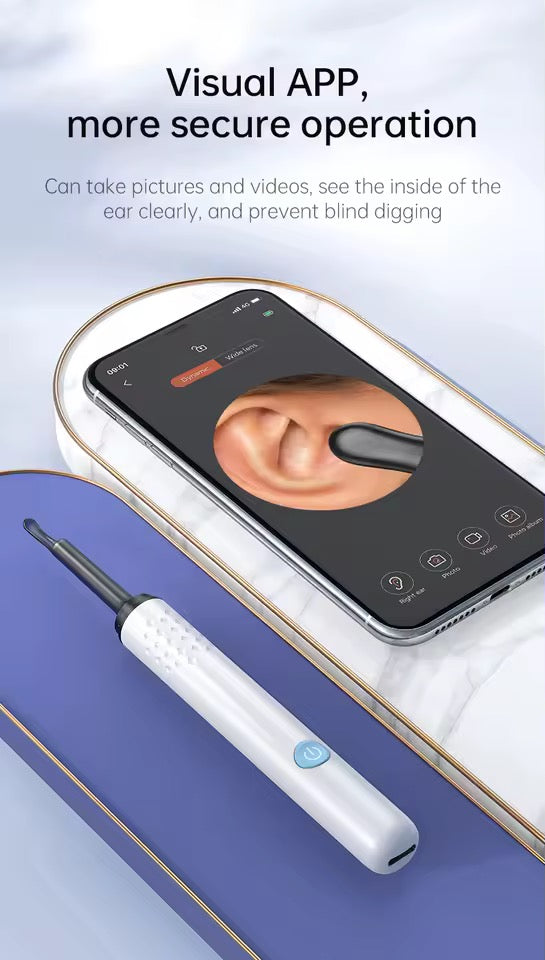 Smart Earwax Remover with 1080P Camera for Android & iPhone