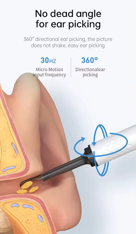Smart Earwax Remover with 1080P Camera for Android & iPhone